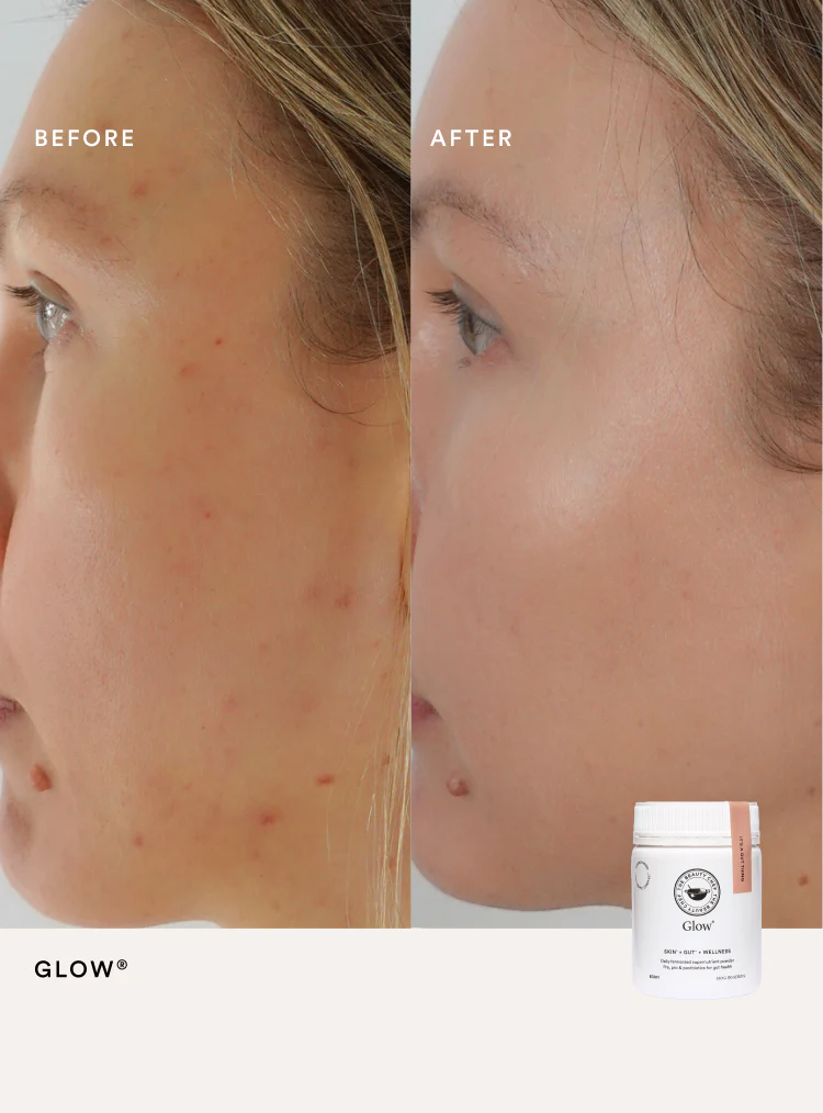 SUPER GLOW KIT - Image 4