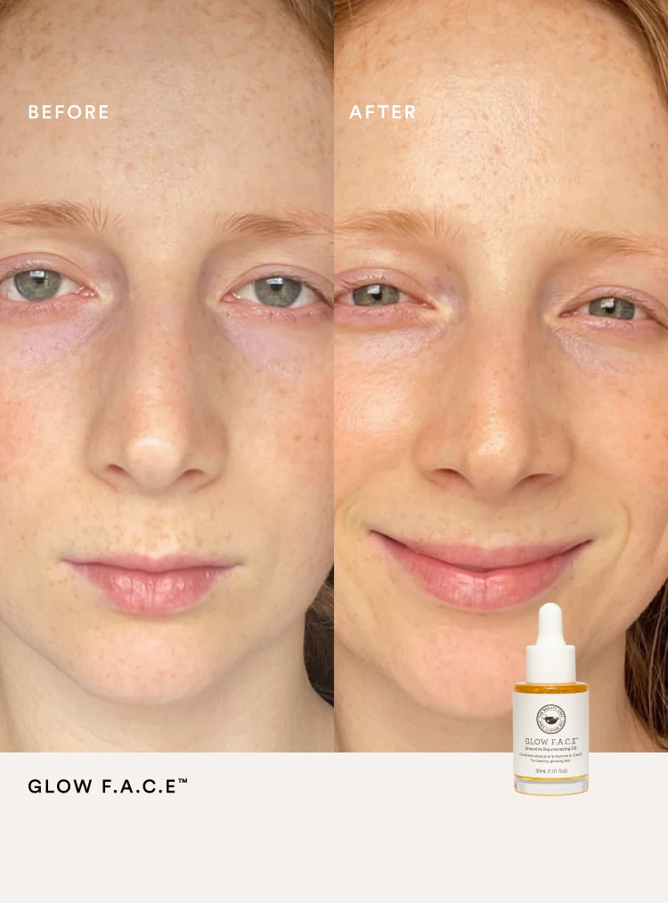 SUPER GLOW KIT - Image 7